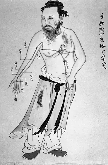 An eighteenth-century Chinese acupuncture chart showing a standing figure covered in named points and channel lines.
